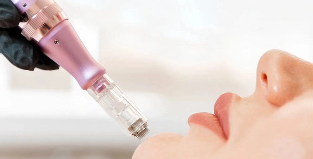 Mikrojehličkování